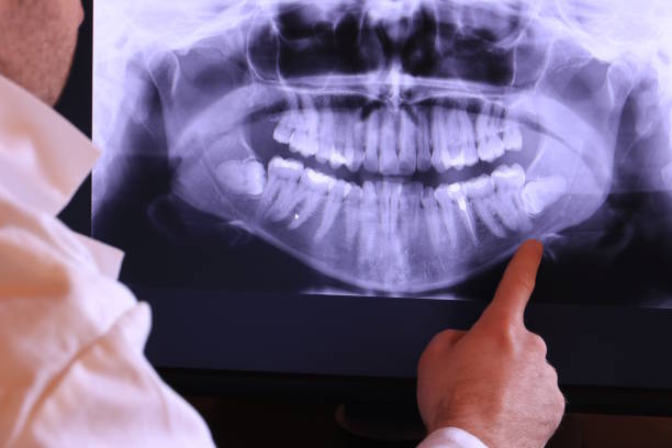 Best Emergency Gum Treatment in Estacada, OR